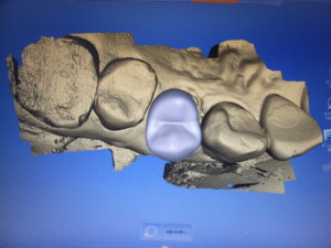歯科界の窮状-6